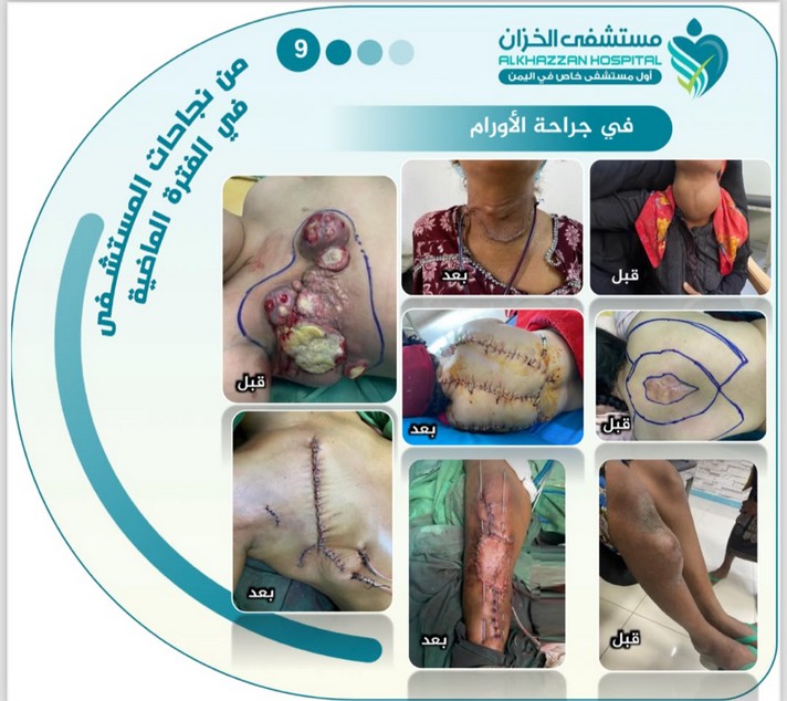 قصة نجاح 2 — مستشفى الخزّان