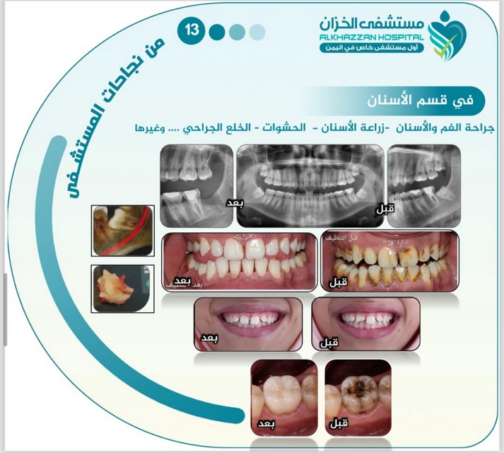 قصة نجاح 4 — مستشفى الخزّان
