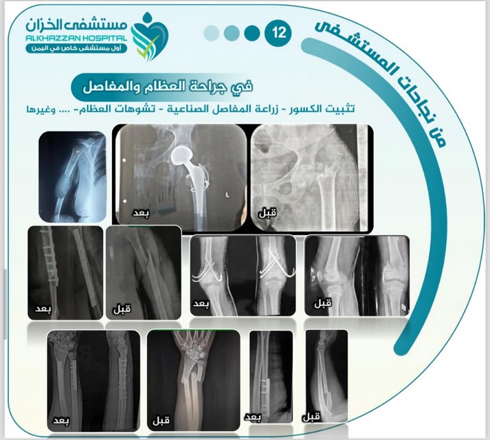 قصة نجاح 5 — مستشفى الخزّان